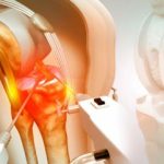 A guide to knee replacement surgery : regain your mobility